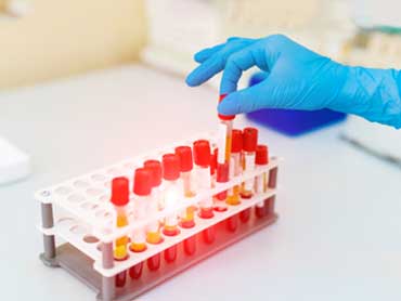 Pharmaceutical Labels