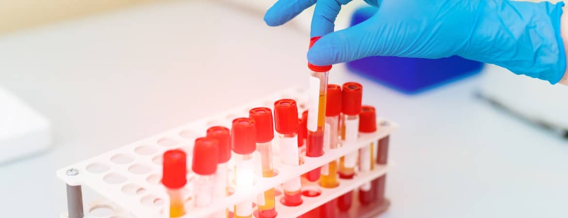 pharma
